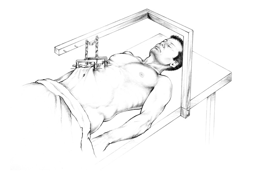 Laporascopy. Medical journal. Pencil.