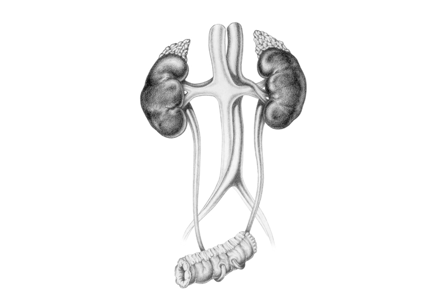 Ileal conduit, kidneys and ureters. Education resource. Pencil.